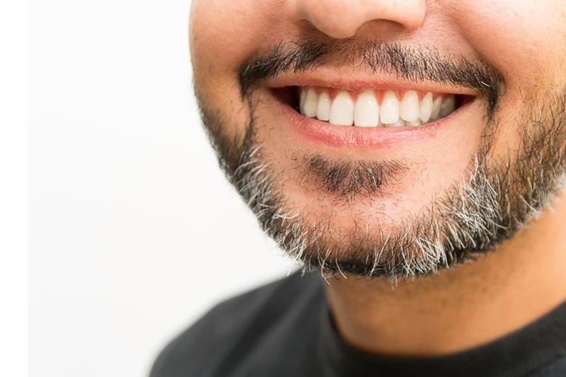 LANAP Laser Treatment  Chicopee, MA ,